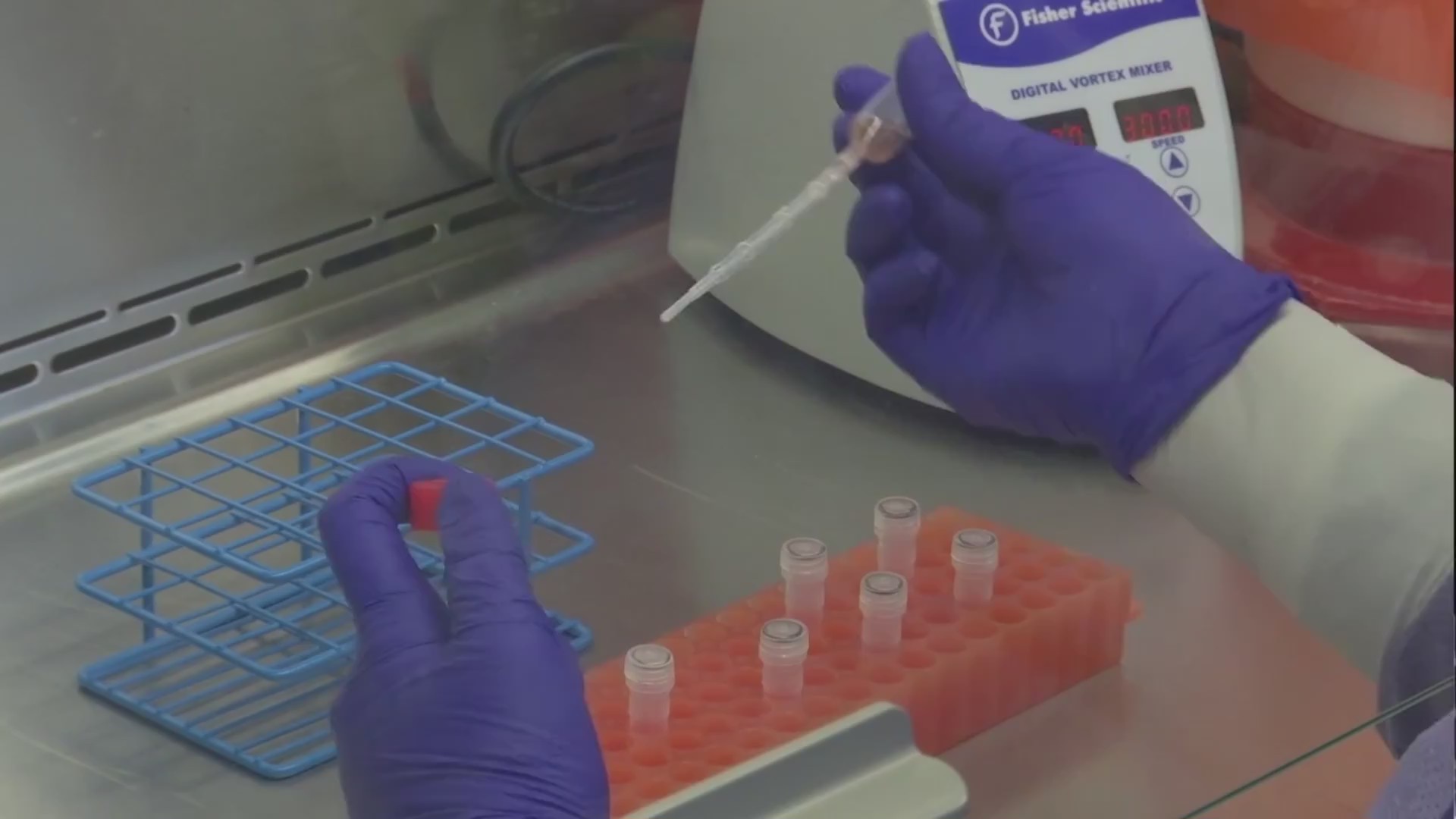 Picture of antibody testing