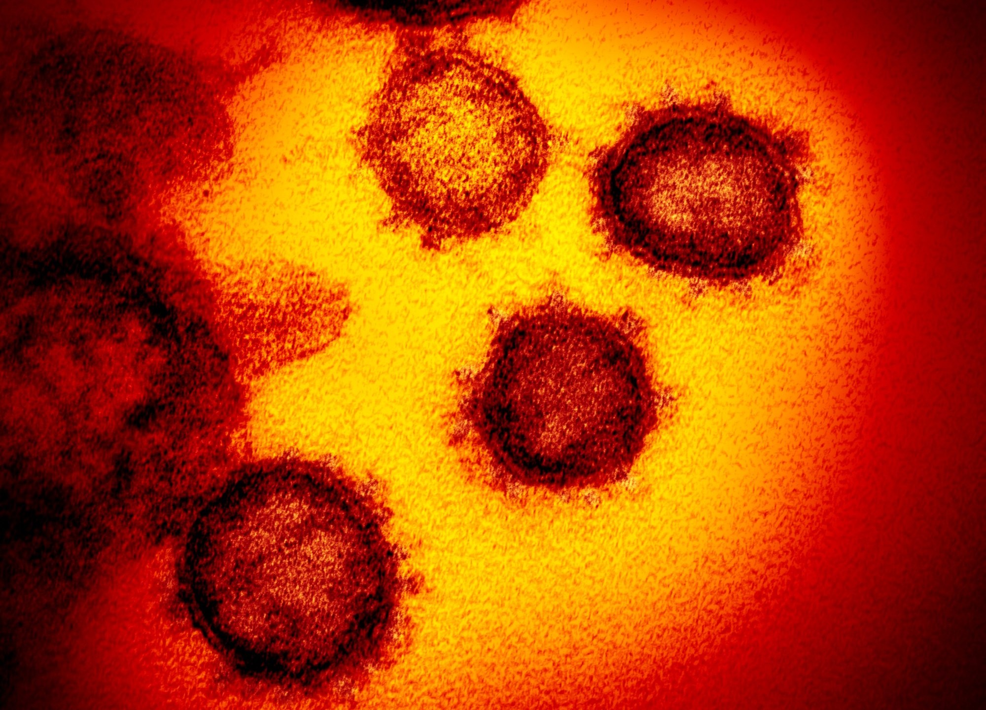coronavirus picture