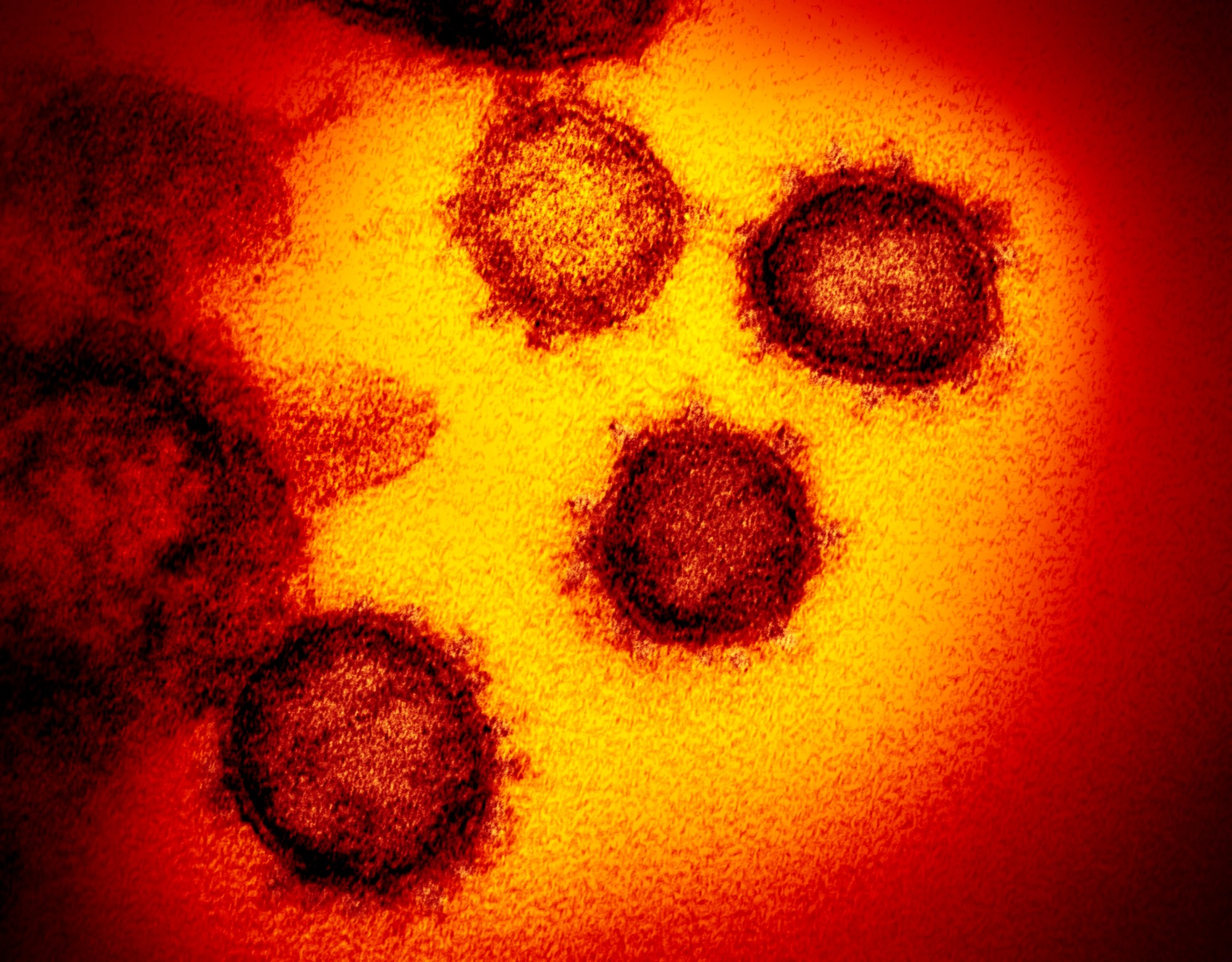 coronavirus picture