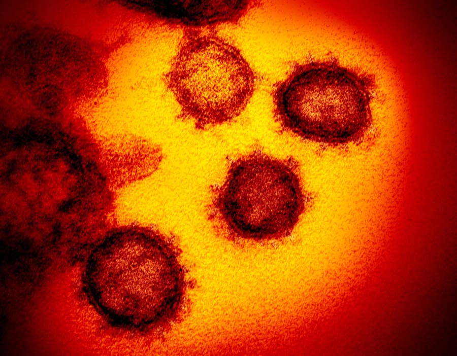 coronavirus picture